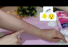 Namazala ujed komarca korom voćke, efekat oduševio 20 miliona ljudi (VIDEO)