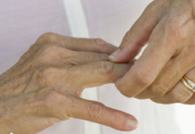 Kosti ne vole ovu hranu: ako jedete ovo, bolovi će biti jači, artritis će se pogoršati, zglobovi će se istrošiti…