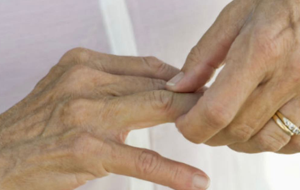 Kosti ne vole ovu hranu: ako jedete ovo, bolovi će biti jači, artritis će se pogoršati, zglobovi će se istrošiti…