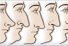 ZVUČI ČUDNO, ALI JE ISTINITO: Evo šta OBLIK NOSA govori O VAMA! Svima je pogodilo