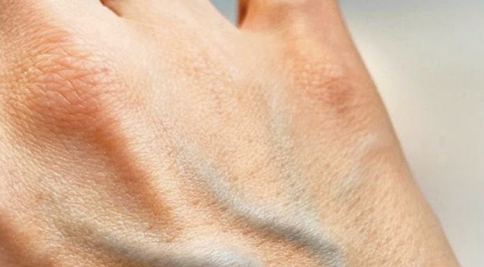 Šokantno, ali istinito: Bez ovih prirodnih lijekova vaše vene i koža su u opasnosti!