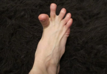 DA LI VAM SE GRČE PRSTI NA STOPALIMA? Evo Na Šta Vas To Upozorava, Može Biti Znak Većih Problema