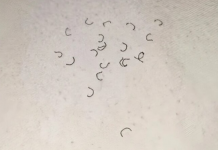 Zašto se na čaršavima pojavljuju vlakna i odakle ona dolaze?