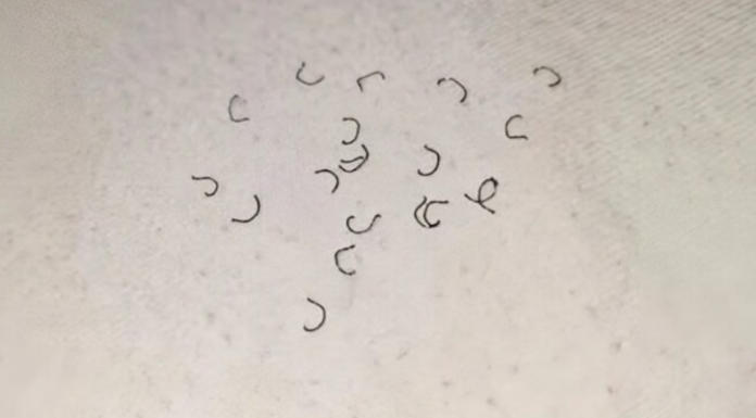 Zašto se na čaršavima pojavljuju vlakna i odakle ona dolaze?