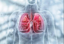 Malo poznati simptomi raka pluća: Evo šta sve treba da znate o kanceru koji odnosi najviše života