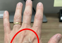 Ako imaš vidljive vene, to znači da si…😨😨‼️