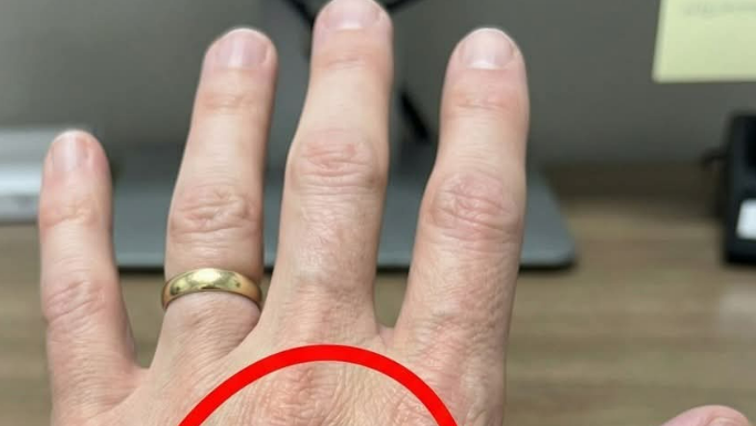 Ako imaš vidljive vene, to znači da si…😨😨‼️