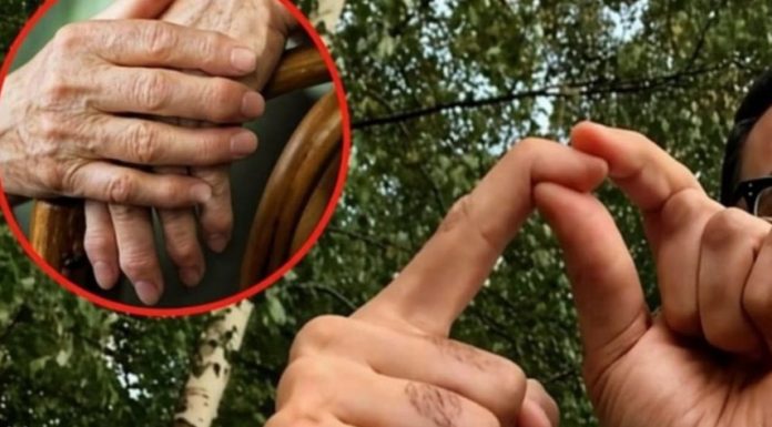 OBLOG KOJI IZVLAČI SAV BOL IZ TIJELA: Provjeren lijek za reumu, išijas, giht i artritis… - featured image